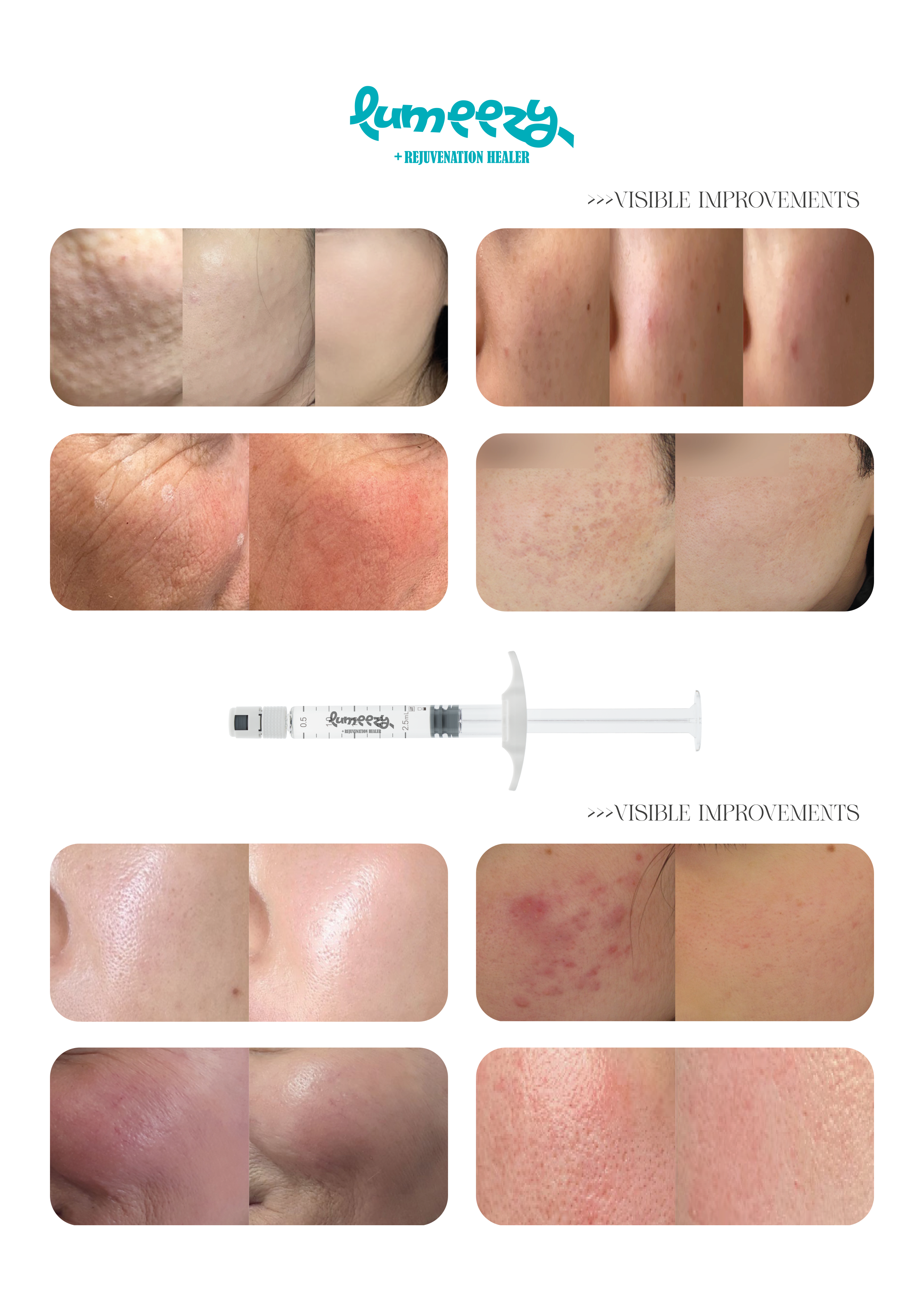 Clinical Results - Before and After